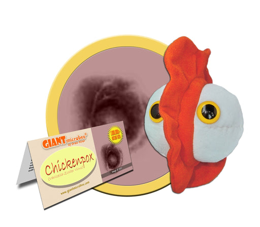 Chickenpox (Varicella-Zoster Virus) - GIANTmicrobes® Plush Toy | img_1 | Foxx Life Sciences Global | shopfls.com